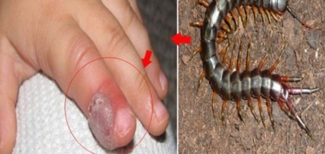 Rết cắn có chết không? Sự thật về nọc độc của loài săn mồi nhiều chân